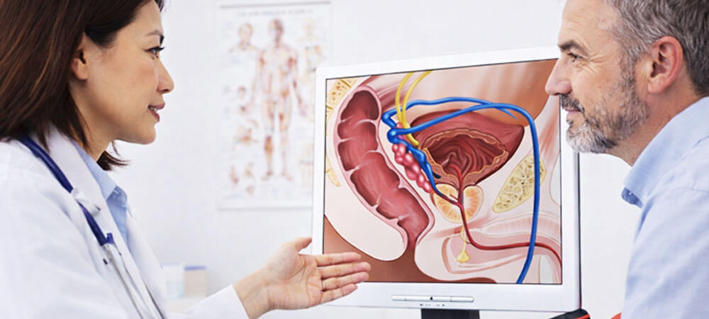 Urological Cancer Screening